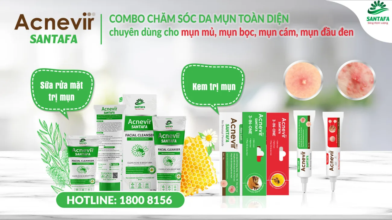 Quy trình 4 bước chăm sóc da mụn đúng cách và hiệu quả mỹ phẩm 2