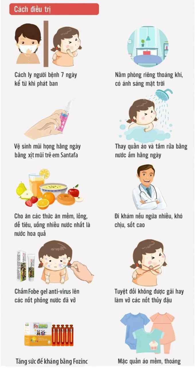 Cảnh báo! Dịch thuỷ đậu đang vào mùa & những điều cần biết Cảnh báo! Dịch thuỷ đậu đang vào mùa & những điều cần biết